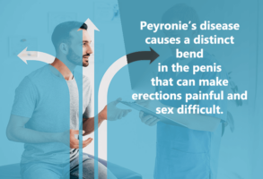 Peyronie's disease causes a distinct bend in the penis that can make erections painful and sex difficult.