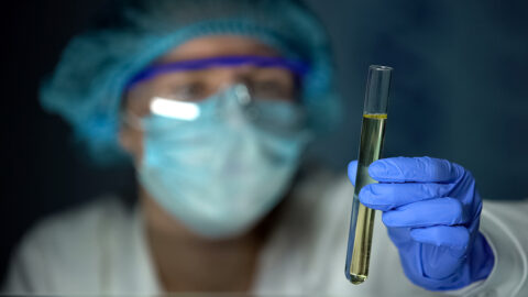 Lab worker holding test tube with urine sample.