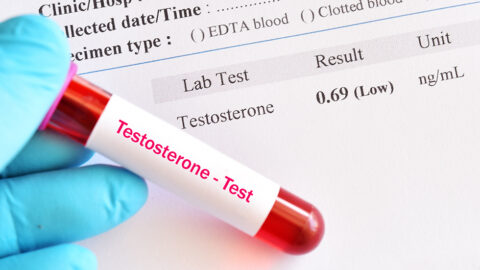 Abnormal low testosterone hormone test result