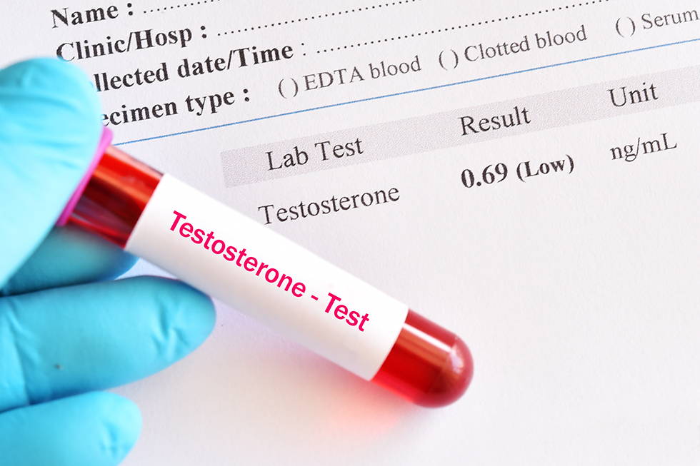 Testosterone Test