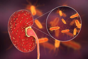 Illustration of bacteria in a kidney