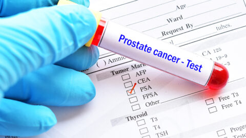 Blood sample tube with lab requisition form for PSA test