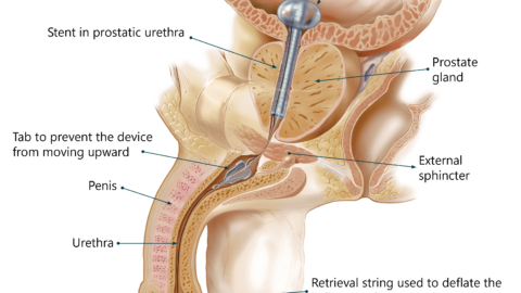 sagittal with description website2